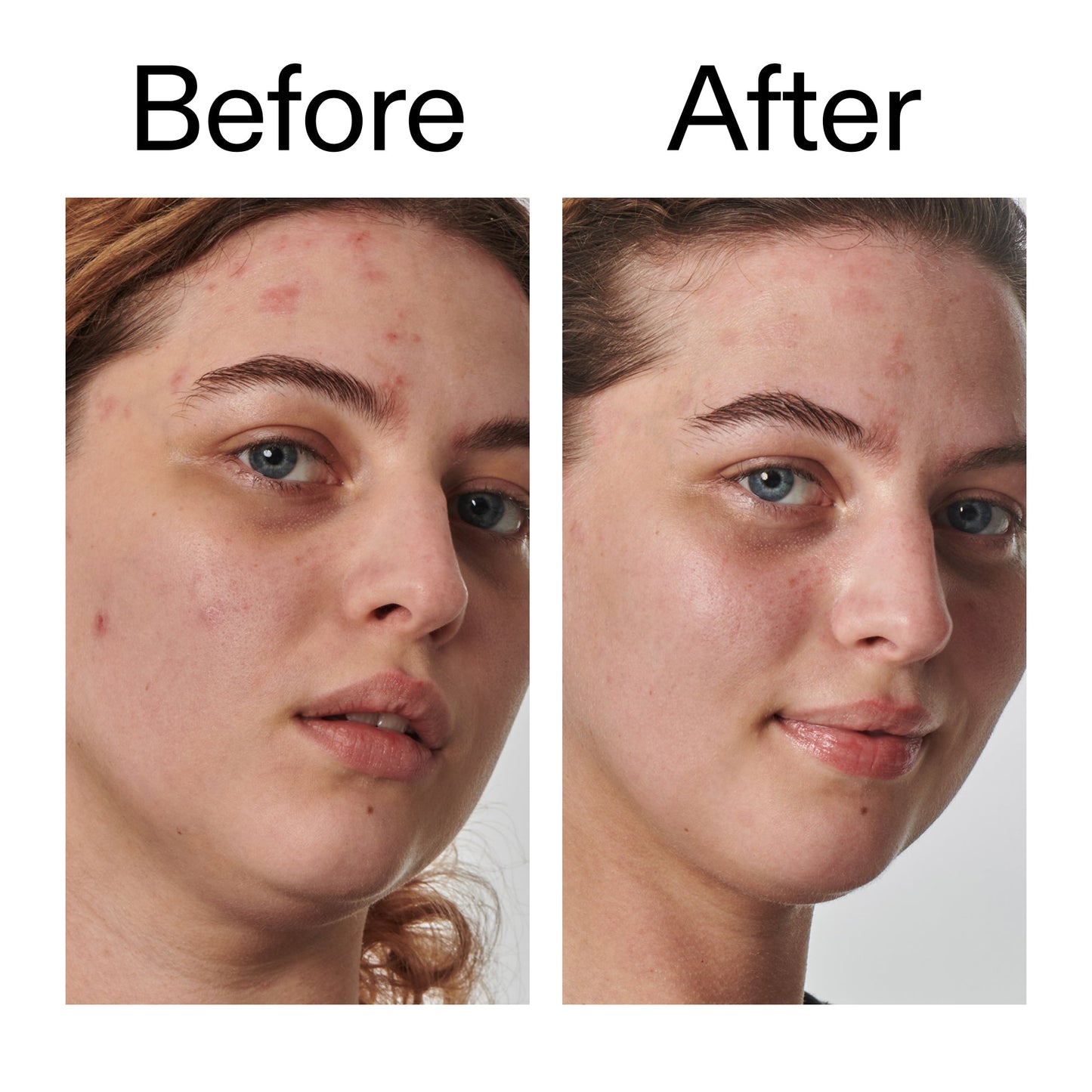 10-urea-moisturizer-s5 Dry_and_Rough_Skin_Solution_Before_After_2000x2000_efa6e639-5c39-49bd-a5dd-f0220293120a.jpg