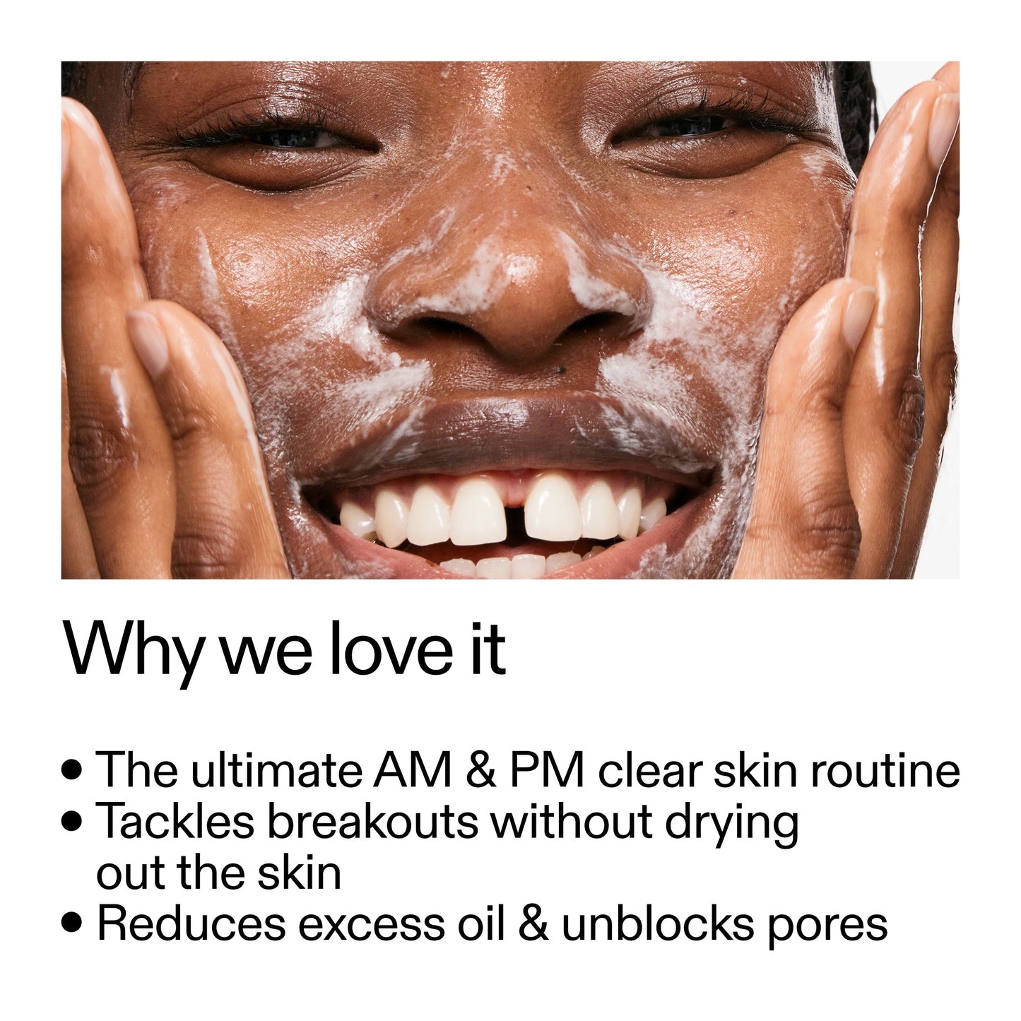 intro-routine-for-acne-l3 Intro_Routine_for_Acne_Why_we_love_it_2000x2000_42499e10-4629-4a0e-a627-7e215f4da6bc.jpg