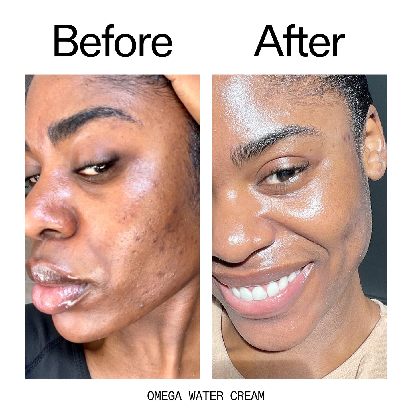 hydrating-cleanser-and-moisturizer-duo-o1 Omega_Water_Cream_Before_After_2000x2000_8e88278b-8c8d-48dc-ac77-4e98ebbd1b77.jpg