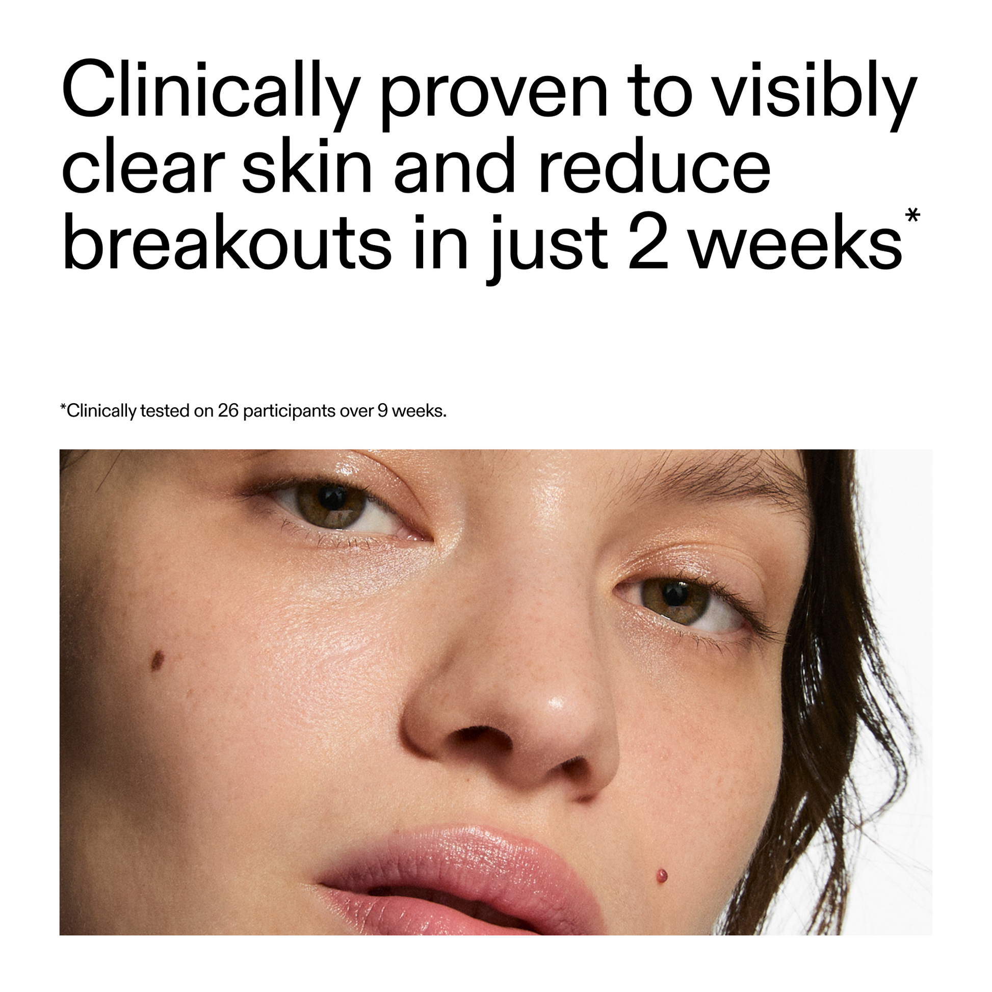 360-acne-clearing-serum-f5 360_Serum_Key_Claim.png