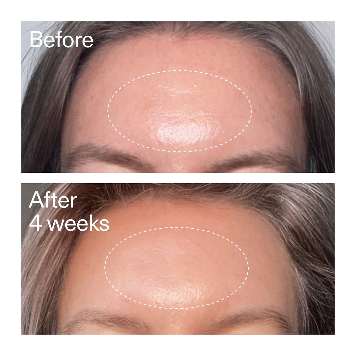 advanced-0-2-retinal-serum-o4 AdvancedRetinal_BeforeAfter1_2000x2000_1da6bb0a-29dd-41d1-95b7-8679696bbf0f.jpg