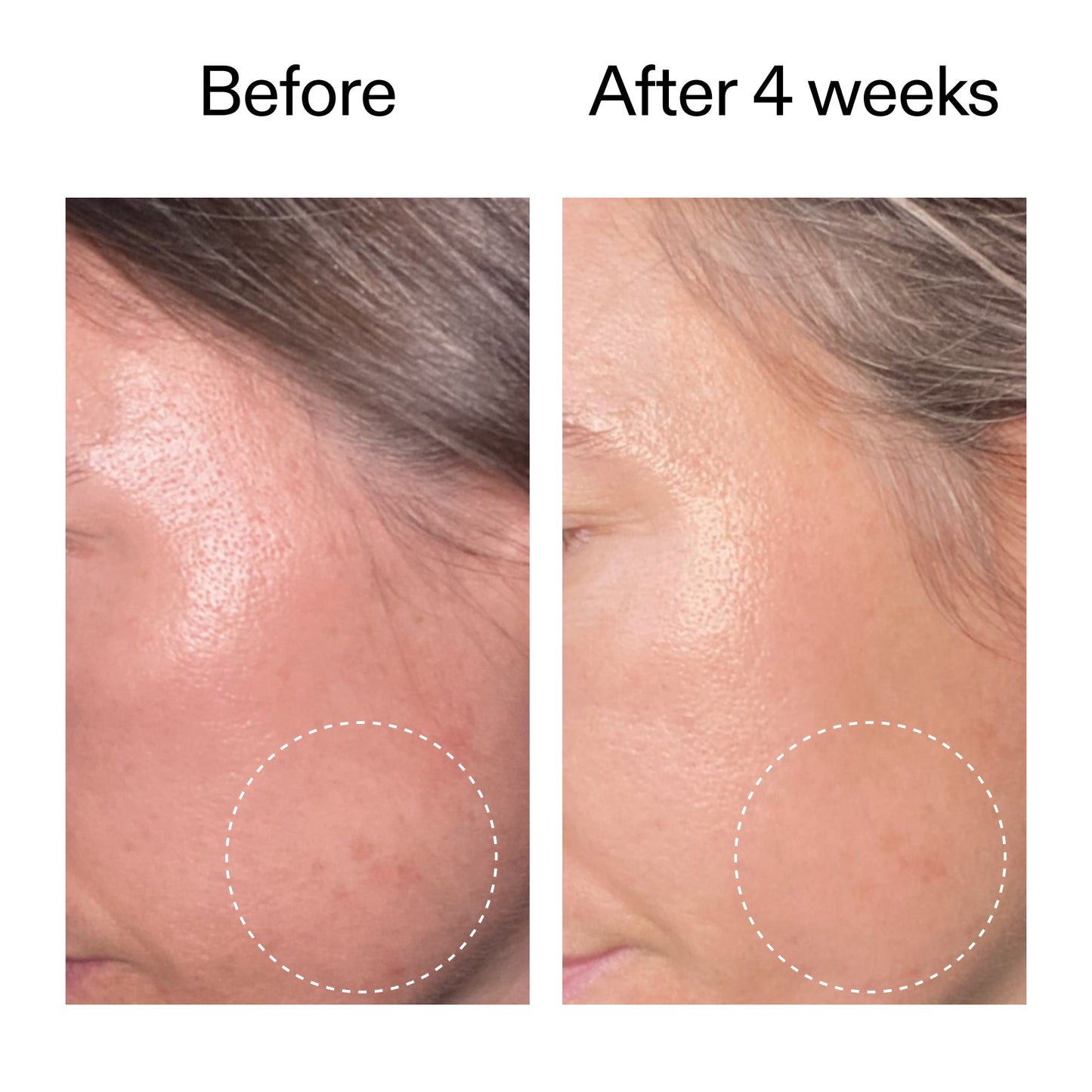 advanced-0-2-retinal-serum-o4 AdvancedRetinal_BeforeAfter2__2000x2000_62fb16bb-77ae-4d63-8500-88dbf847f4b9.jpg