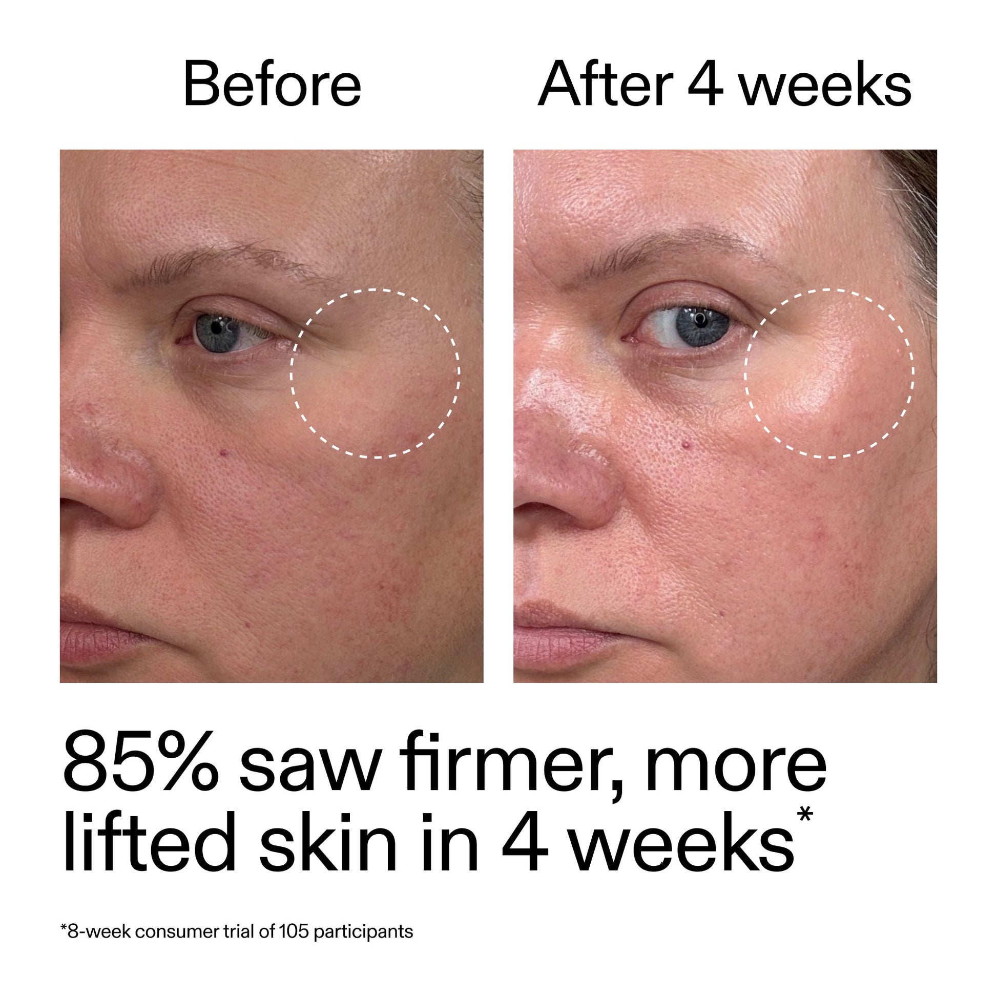 advanced-0-2-retinal-serum-duo-a9 AdvancedRetinal_BeforeAfter_Claim1_2000x2000_3a315aa8-f408-4b33-bbeb-0d9209f98404.jpg