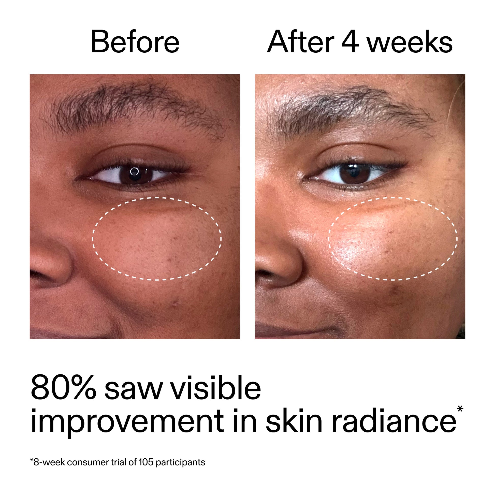 advanced-0-2-retinal-serum-duo-a9 AdvancedRetinal_BeforeAfter_Claim2_2000x2000_681b621d-8d44-4d44-9a40-89244f9b2e53.jpg