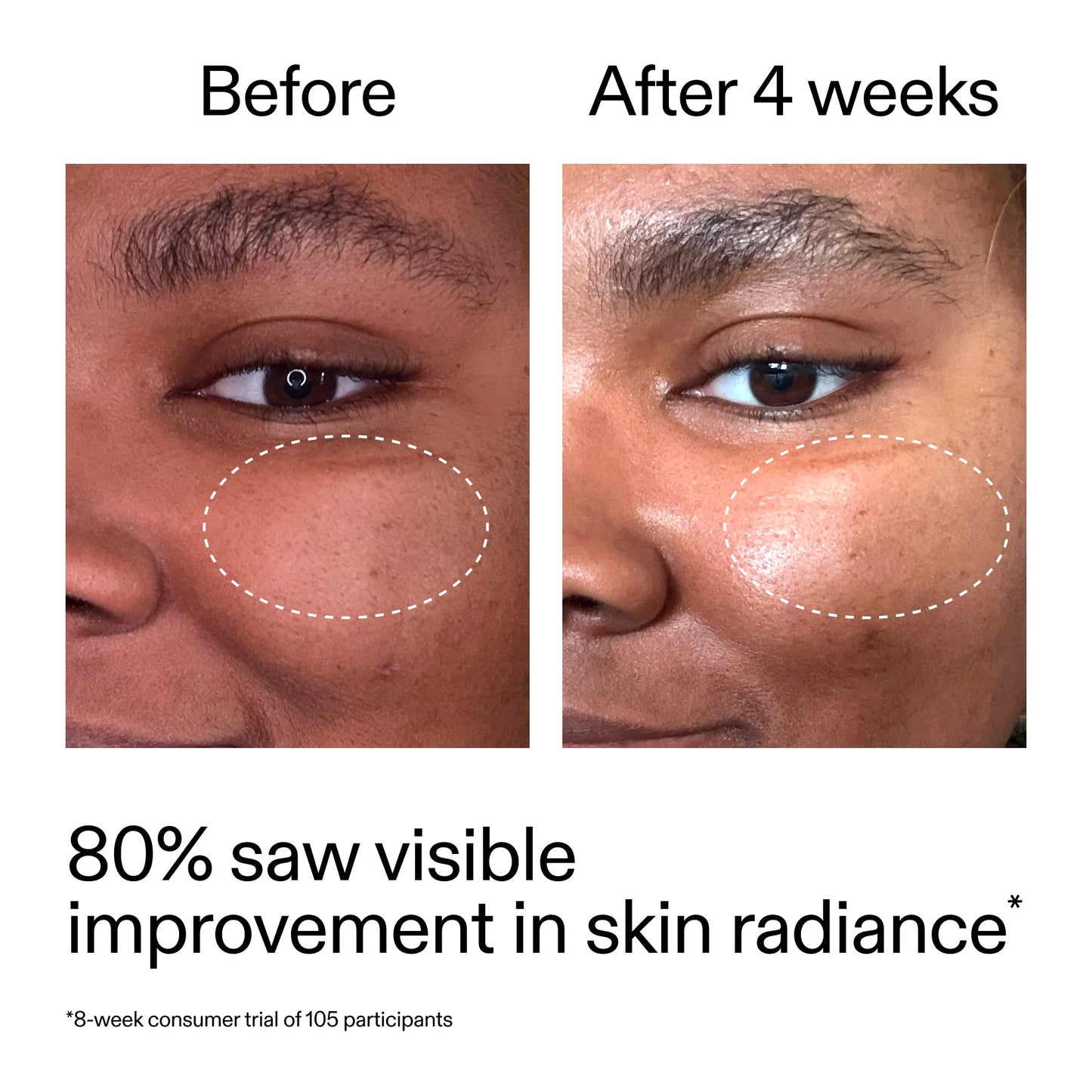 advanced-0-2-retinal-serum-o4 AdvancedRetinal_BeforeAfter_Claim2_2000x2000_39d11e3d-eda9-44ec-ab32-2903b1a368bd.jpg