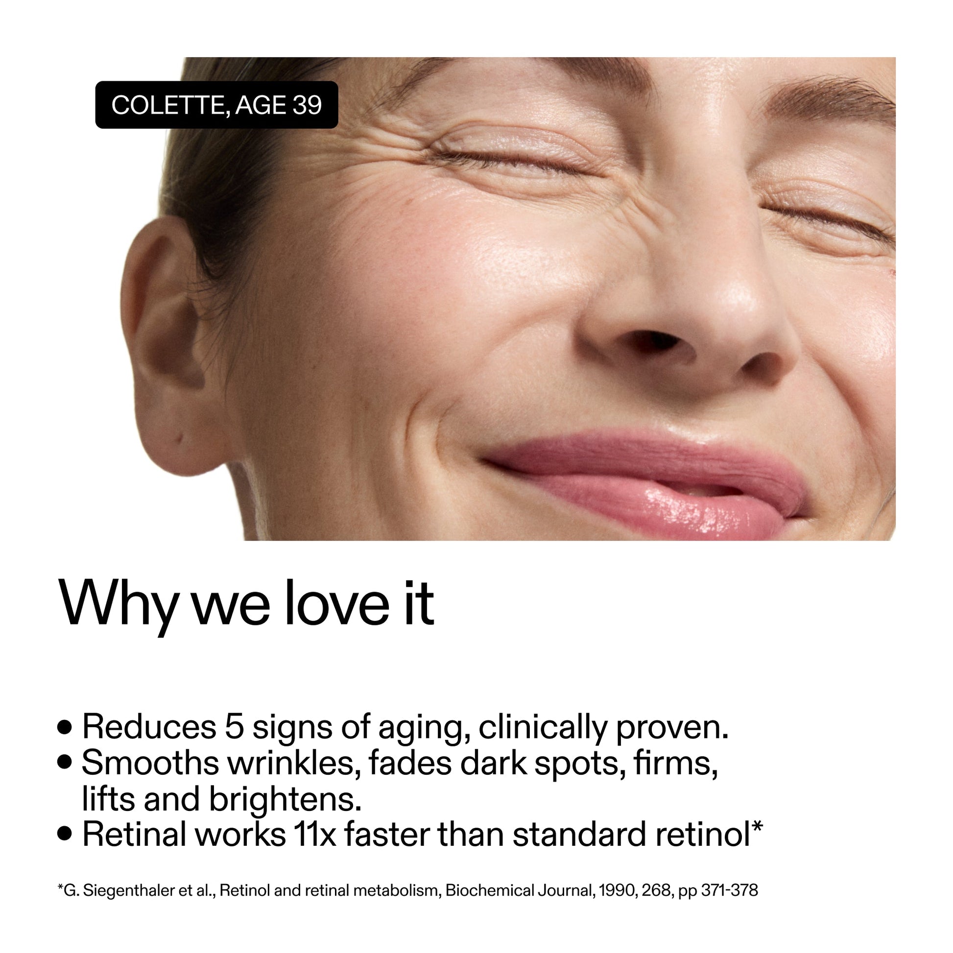 advanced-0-2-retinal-serum-o4 AdvancedRetinal_Whyweloveit_2000x2000_a3b5bf44-6009-46f0-b045-4955a4b780c8.jpg