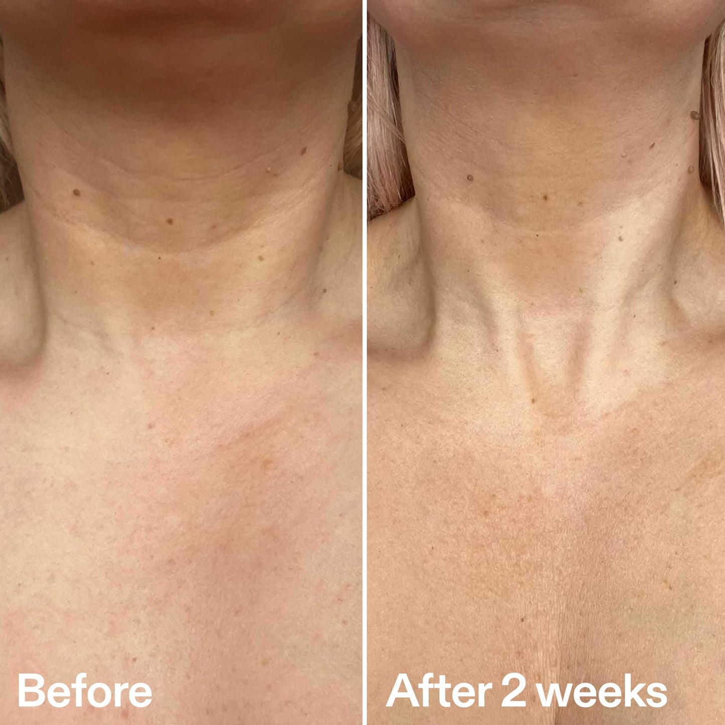 bio-active-neck-lift-stick-d0 B_A_2.jpg