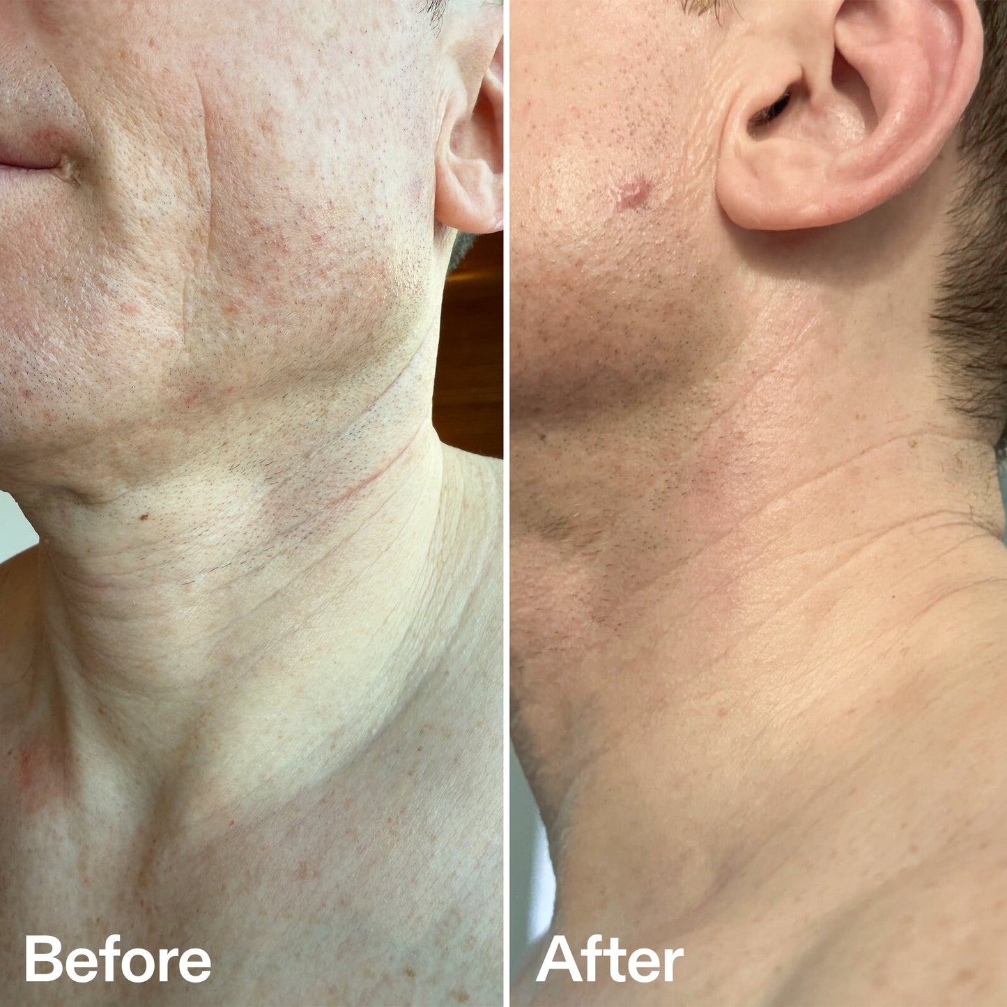 bio-active-neck-lift-stick-d0 B_A_afa2743e-b8e2-4504-92f4-e281cb6cf759.jpg