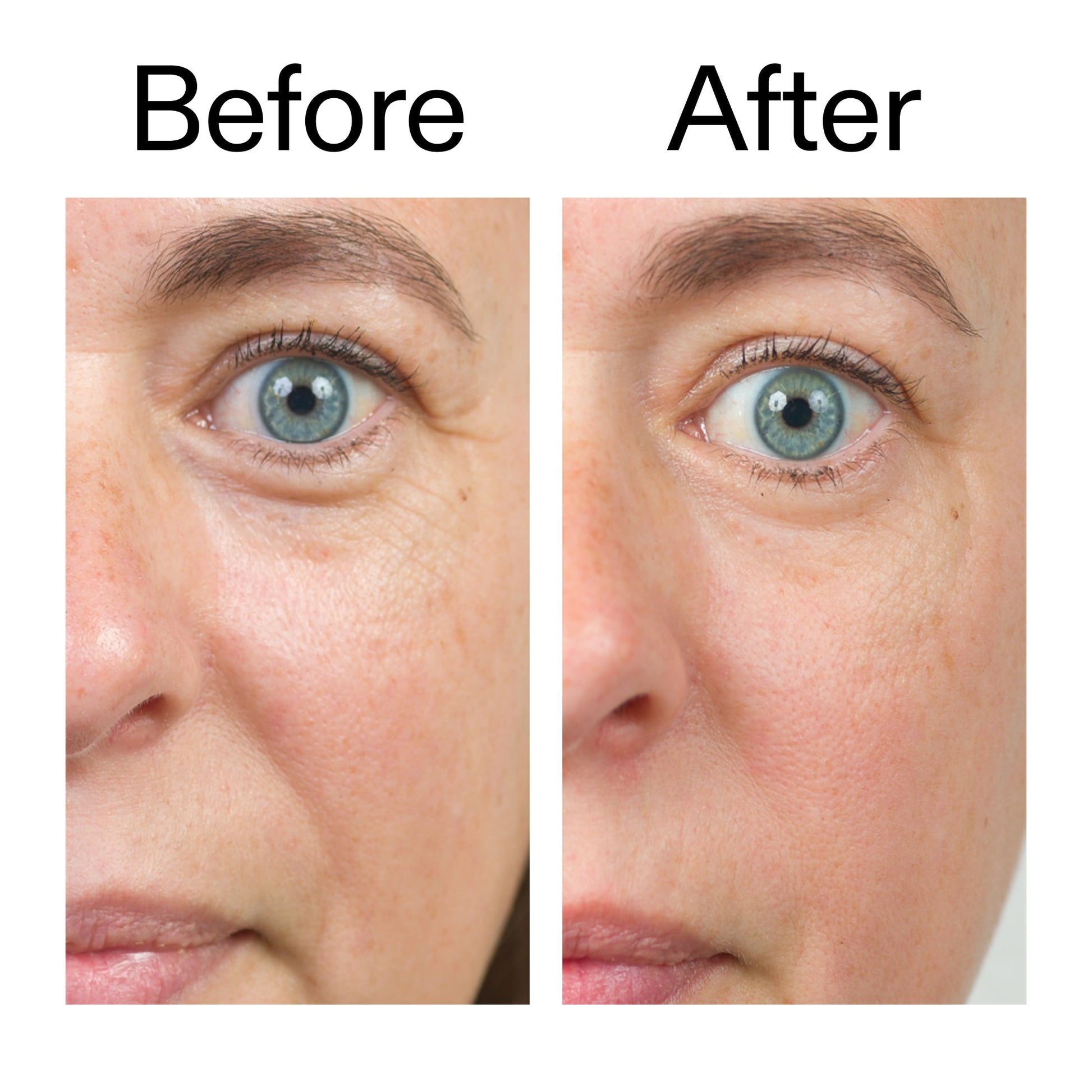 bio-active-ceramide-moisturizer-g7 Bio-Active_Before_After_2000x2000_566e5a9e-135e-417a-8242-b44e5fa35463.jpg
