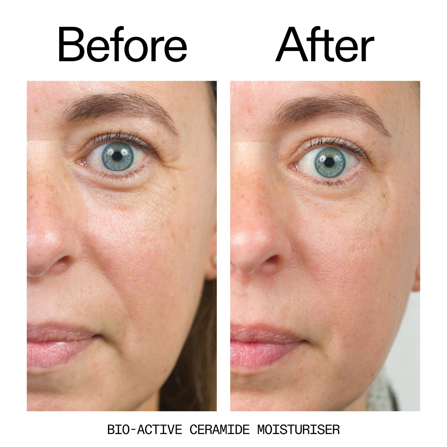 barrier-boosting-trio-j7 Bio-Active_Before_After_2000x2000_600947b4-e8c5-425a-9155-fc15bc83aa12.jpg