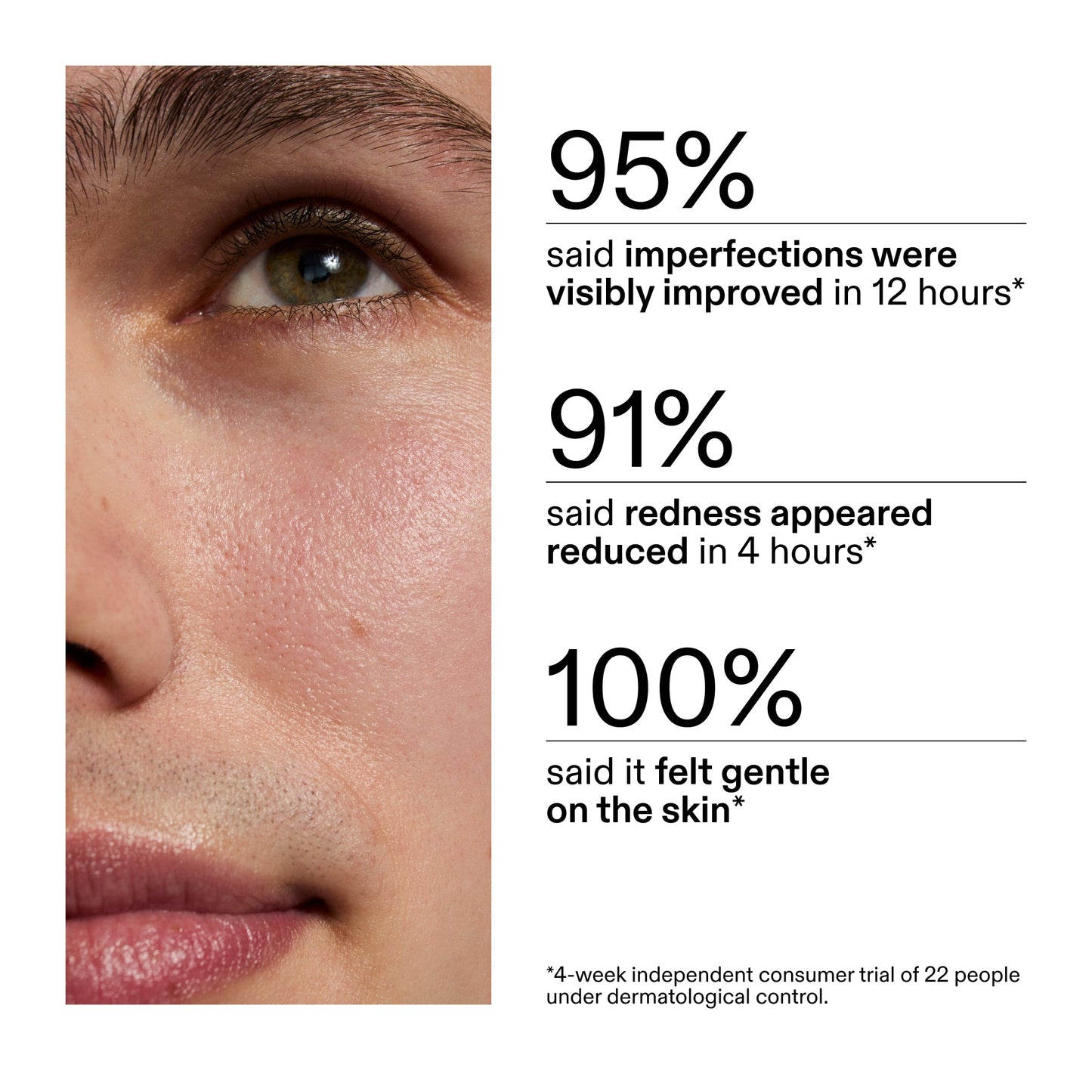 succinic-acid-acne-treatment-a9 CA_Succinic_Acid_Treatment_key_Claims_2000x2000_db91b0f1-7f29-4bfe-bb16-63a47f500960.jpg