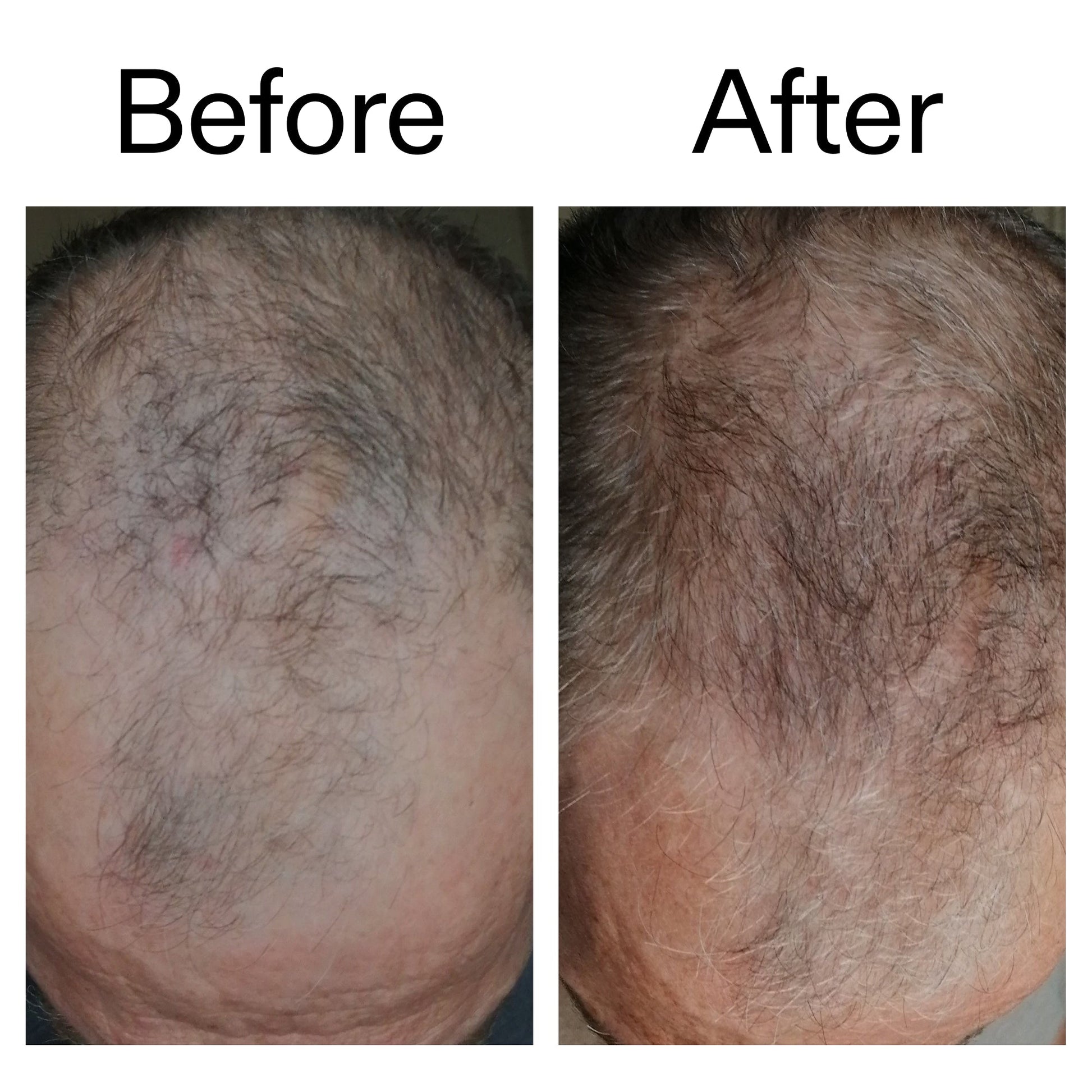 3-month-hair-growth-trio-c8 Caffeine_Scalp_Treatment_B_A_Ppage_2000_x_2000.jpg