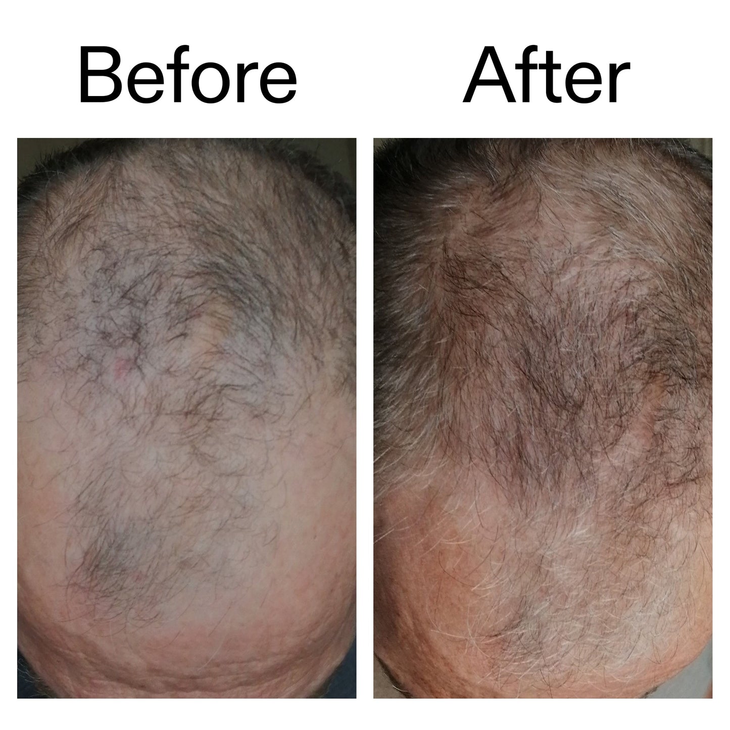 caffeine-stimulating-scalp-treatment-d8 Caffeine_Scalp_Treatment_B_A_Ppage_2000_x_2000.jpg