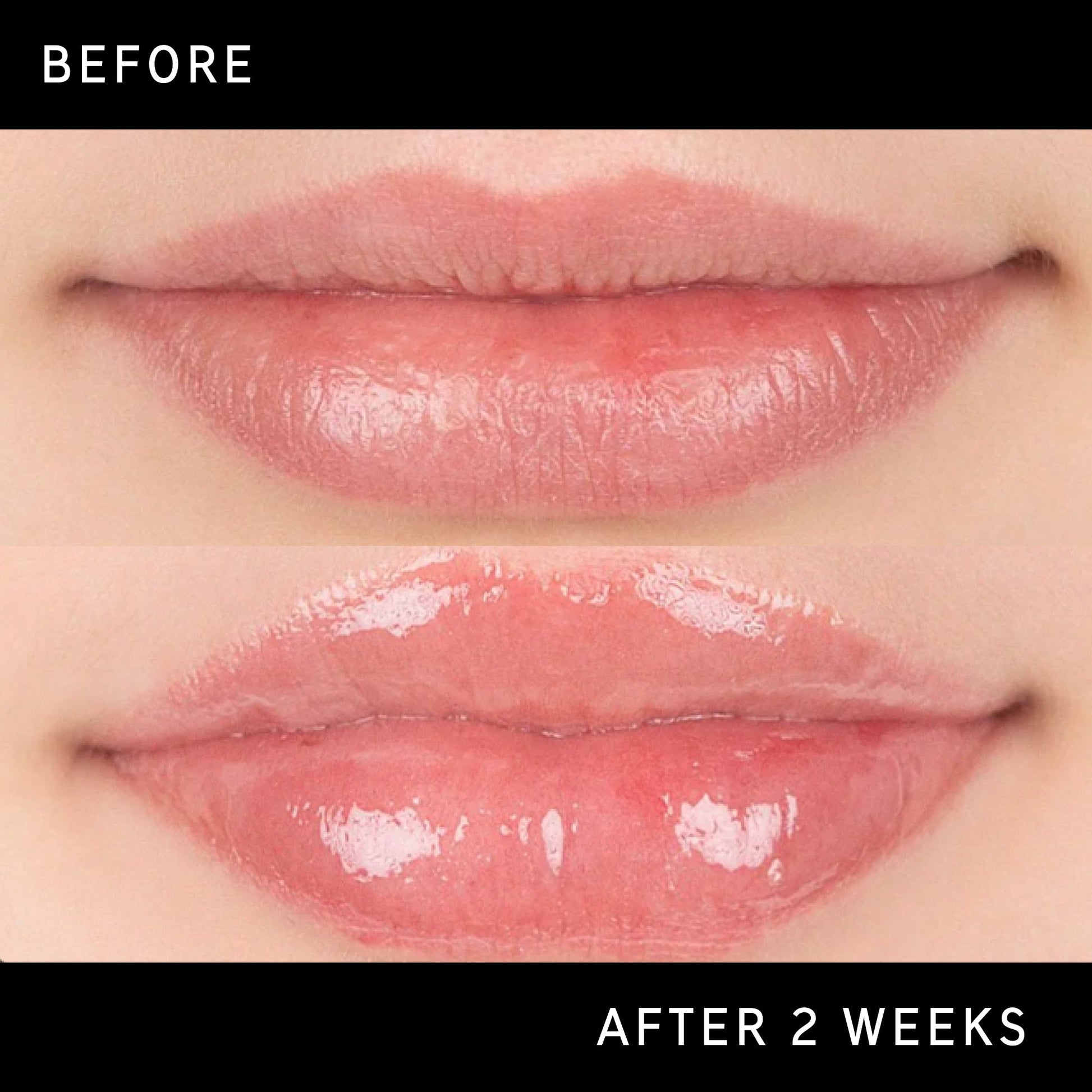 lip-plumping-duo-u5 DTC-Top15_Amends_Tripeptide-Lip_B_A.jpg