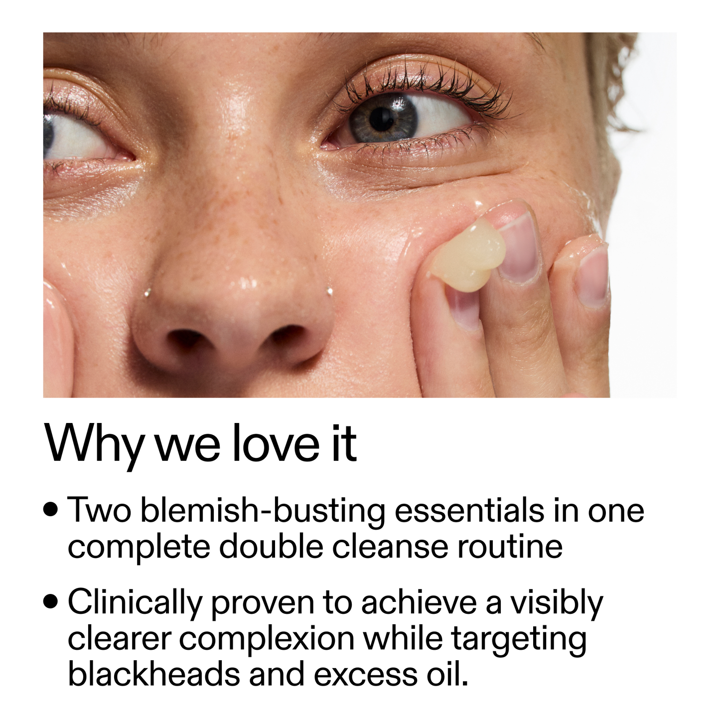 acne-double-cleanse-duo-j3 Double_Cleanse_Duo_for_Breakouts_Why_We_2000x2000_f242cb12-bb5c-487c-b203-071ccb406ec5.png