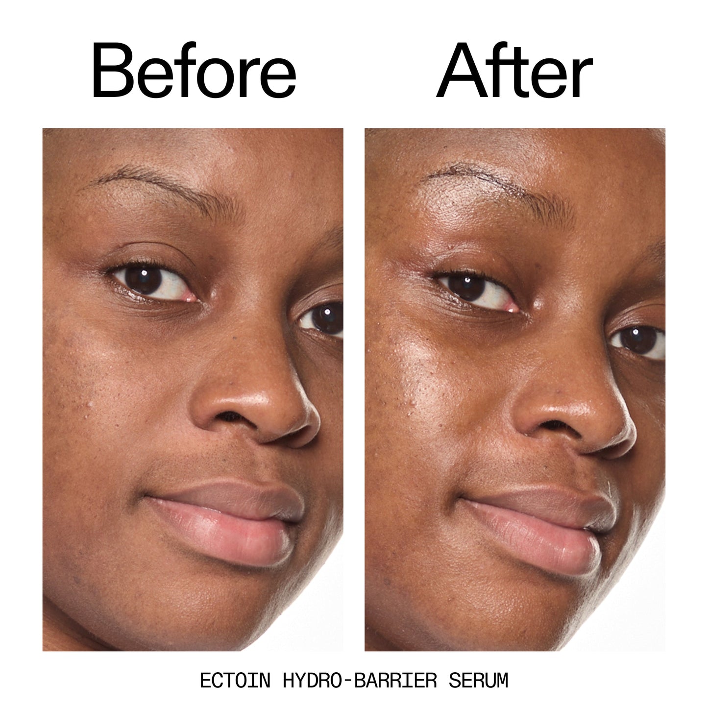 barrier-boosting-trio-j7 Ectoin_Before_After_2000x2000_ce35bc41-4da0-4b6f-adc7-29f8641f6c6c.jpg