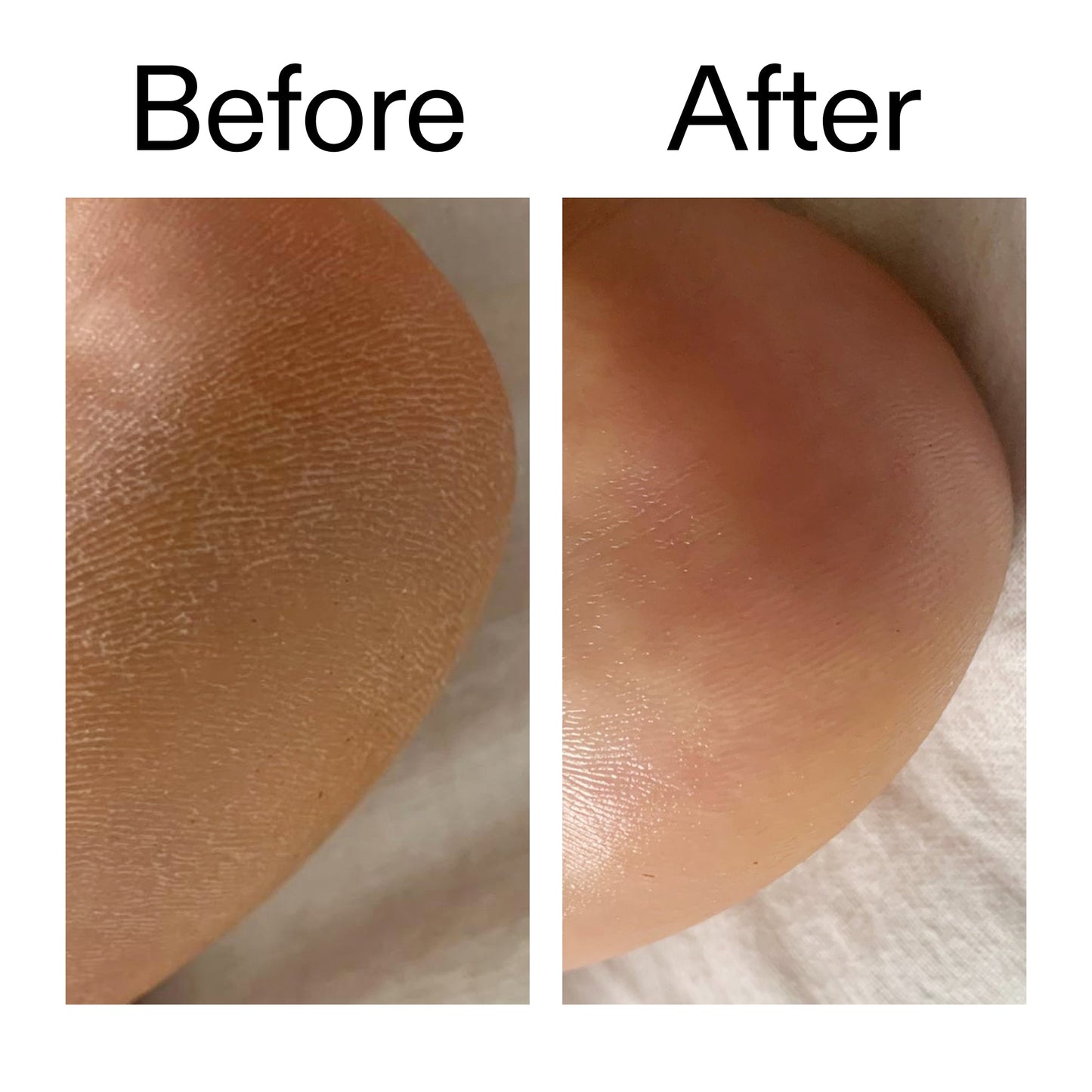glycolic-acid-exfoliating-body-stick-v6 Glycolic_Acid_Exfoliating_Body_Stick_Before_After_V1_2000x2000_a3043625-9400-429a-a7fb-d6dbd220f722.jpg