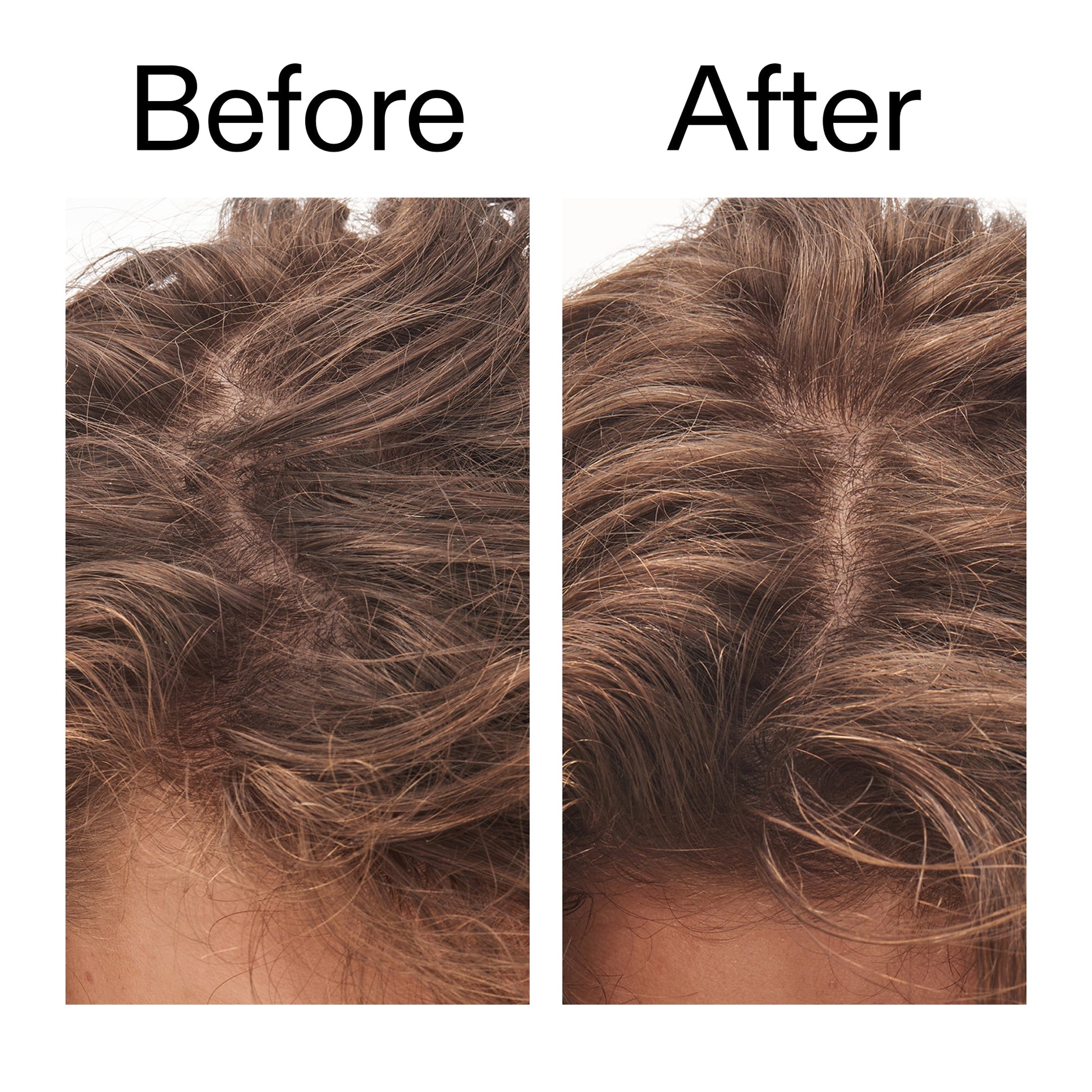 glycolic-acid-exfoliating-scalp-scrub-f1 Glycolic_Acid_Exfoliating_Scalp_Scrub_Before_After_2000x2000_b8561c87-05a1-4caa-80f7-1b6b33d750f7.jpg