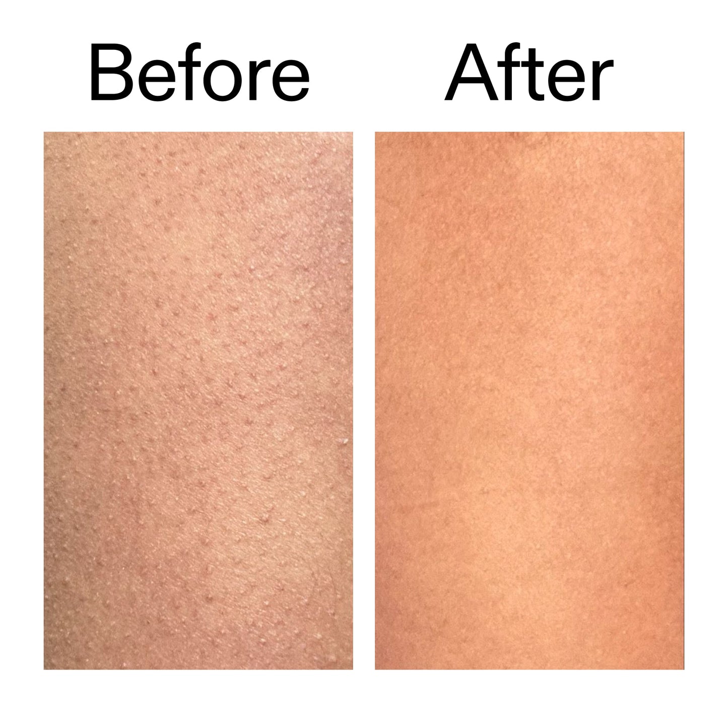 glycolic-acid-exfoliating-body-stick-duo-b0 Glycolic_Body_Stick_B_A_2000x2000_6e6e6b4d-5bd7-43c0-aeed-4d66788e8995.jpg