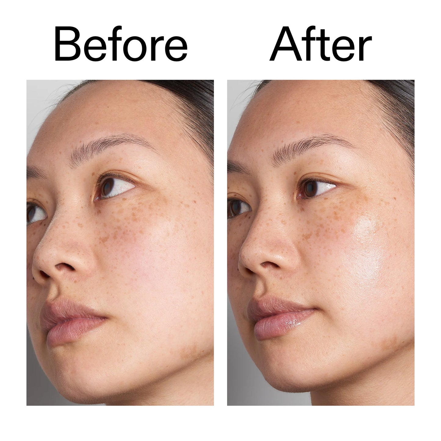 hyaluronic-acid-serum-60ml-e0 Hyaluronic_Acid_Before_After_2000x2000_d7983956-8aa2-4ea3-8255-c63e8d4f892e.jpg