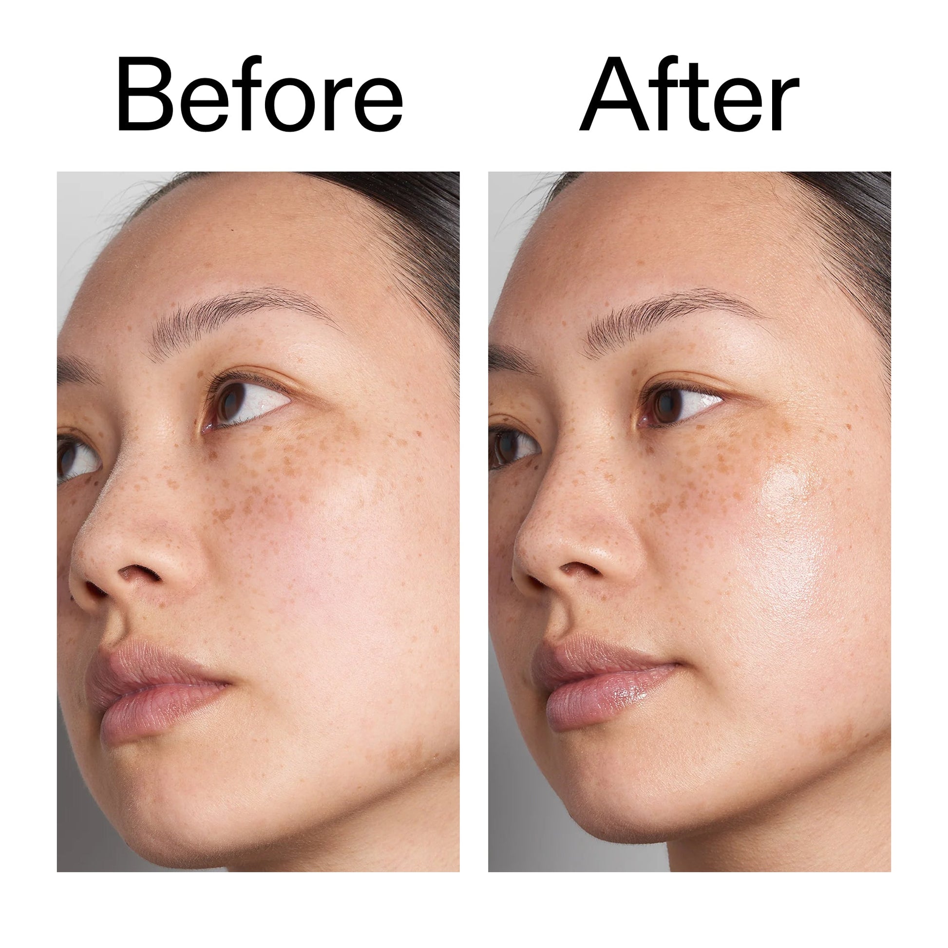 hyaluronic-acid-serum-30ml-t3 Hyaluronic_Acid_Before_After_2000x2000_d7983956-8aa2-4ea3-8255-c63e8d4f892e.jpg