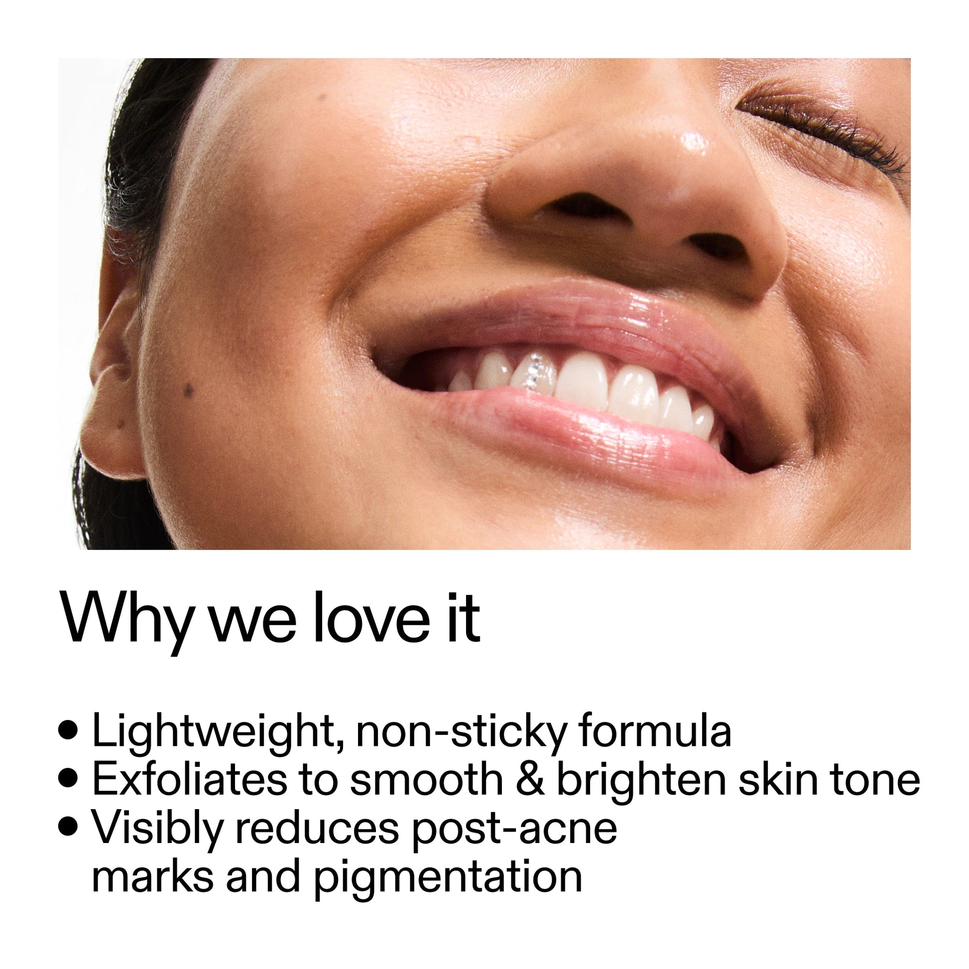 mandelic-acid-treatment-n8 Mandelic_Acid_Treatment_Why_we_love_it_2000x2000_6dfe29a9-2a79-464f-a5e8-e5ac37d93388.jpg