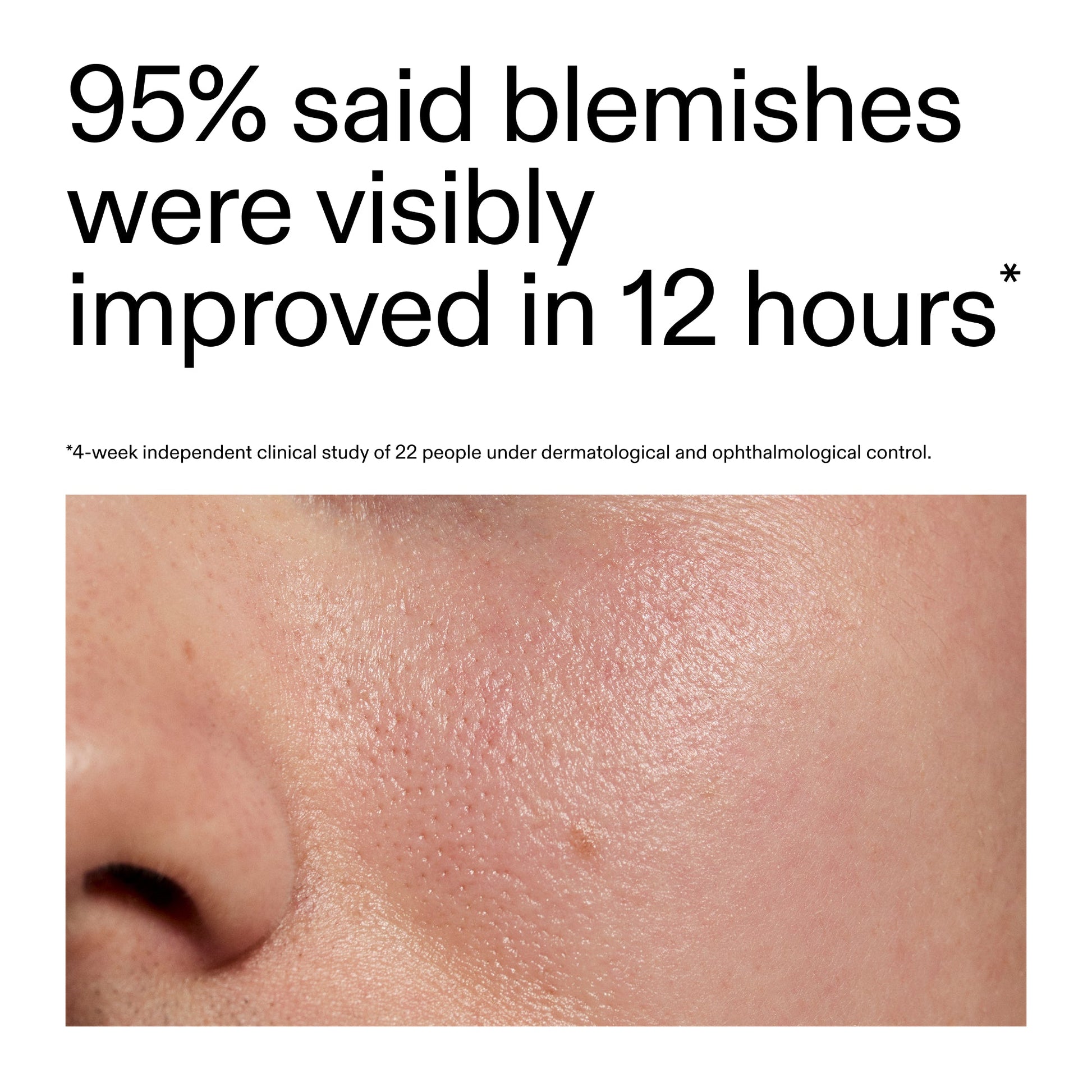 succinic-acid-acne-treatment-a9 Oat_Cleansing_Balm_Claim_2000x2000_ac6ce553-25db-41b2-a981-faae1ac4b8c0.jpg