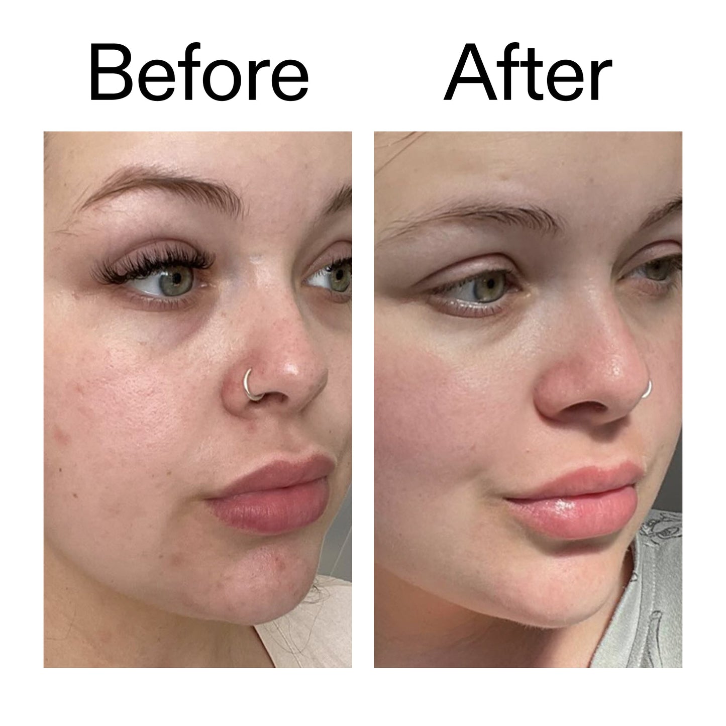 supersize-omega-water-cream-100ml-f9 Omega50_Before_After_2000x2000_46483ed8-3f9d-487f-9a0c-9df79830bd65.jpg