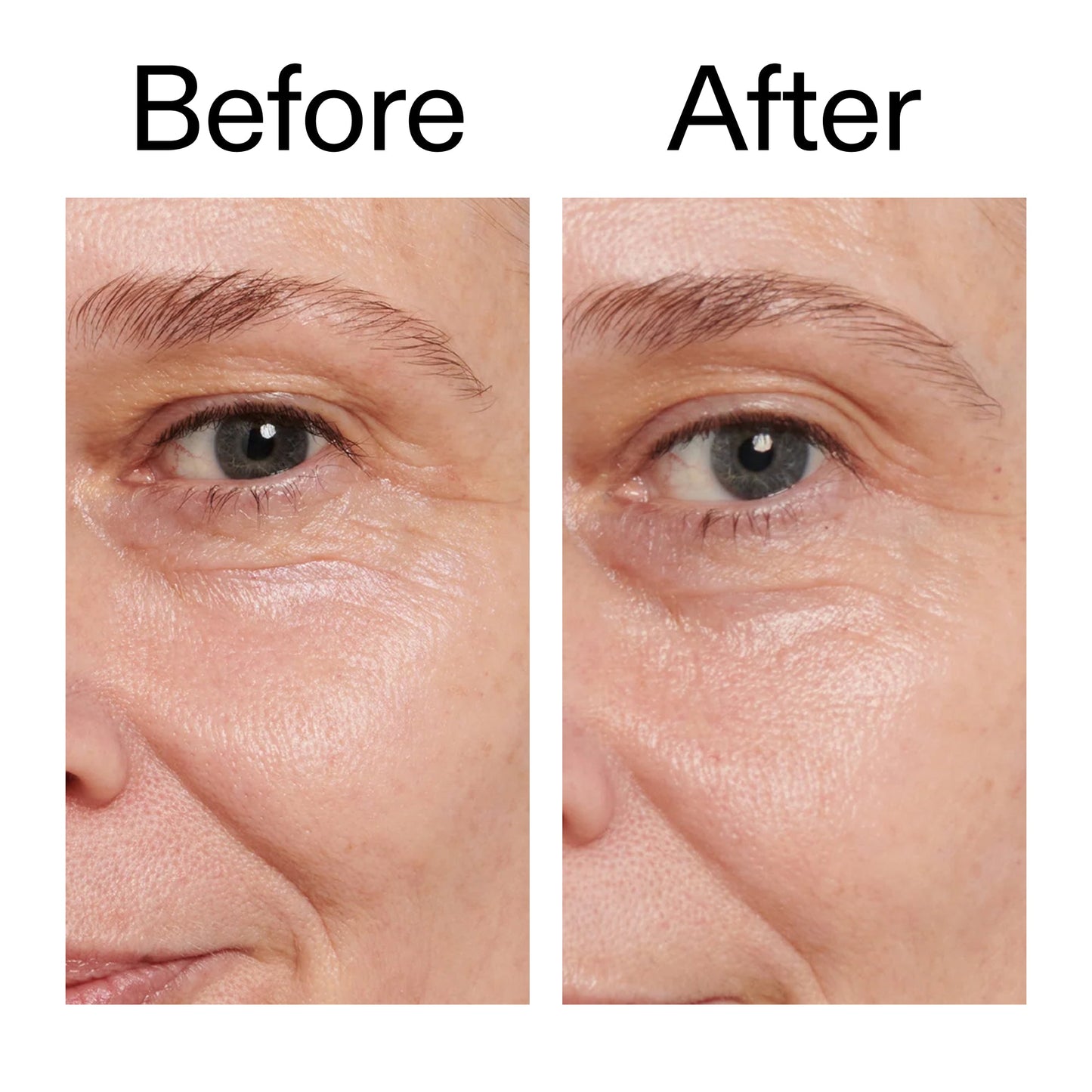 retinol-eye-cream-y6 Retinol_Eye_Cream_Before_After_2000x2000_ac03a80c-109e-4572-a95a-91dc109b4d27.jpg