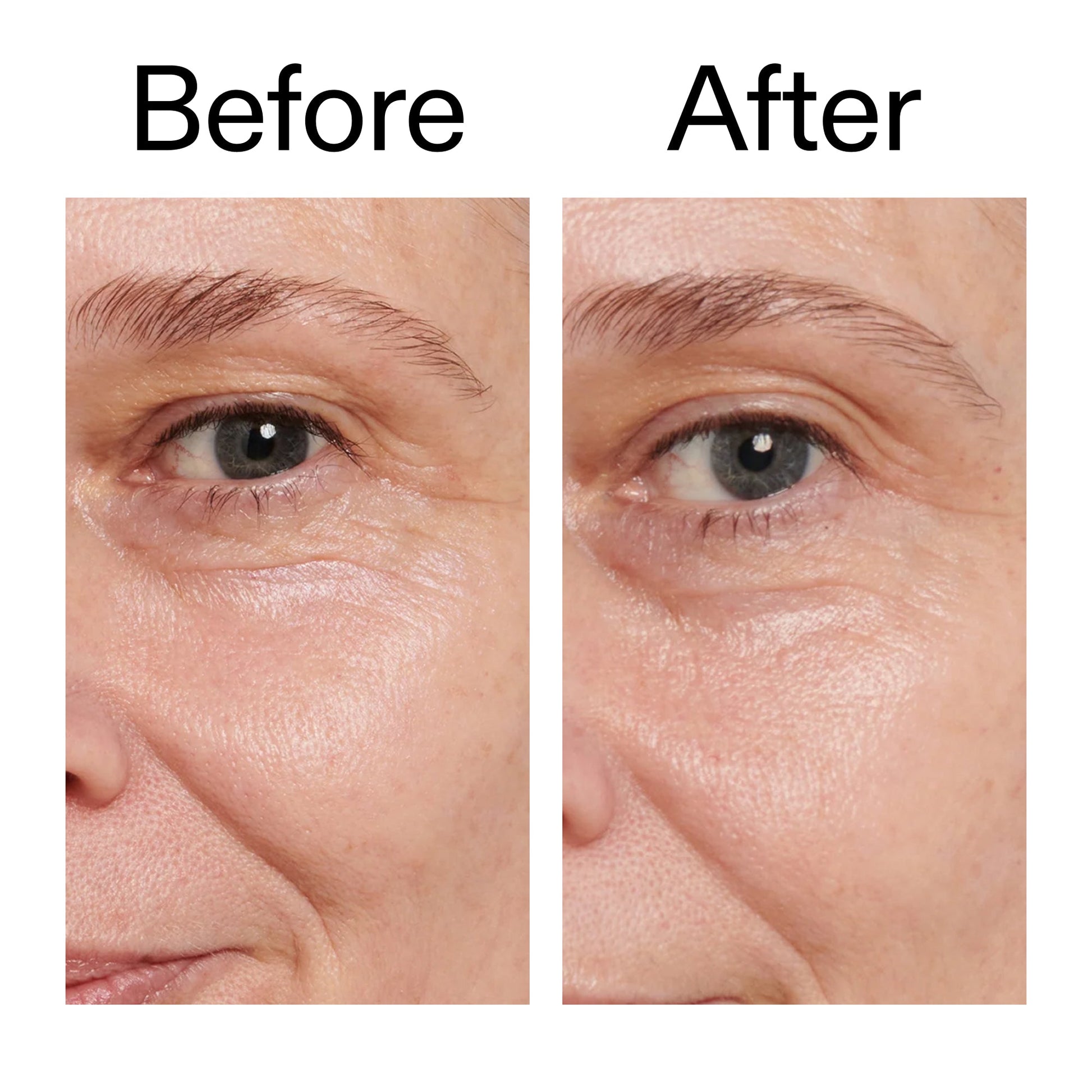 retinol-eye-cream-y6 Retinol_Eye_Cream_Before_After_2000x2000_ac03a80c-109e-4572-a95a-91dc109b4d27.jpg
