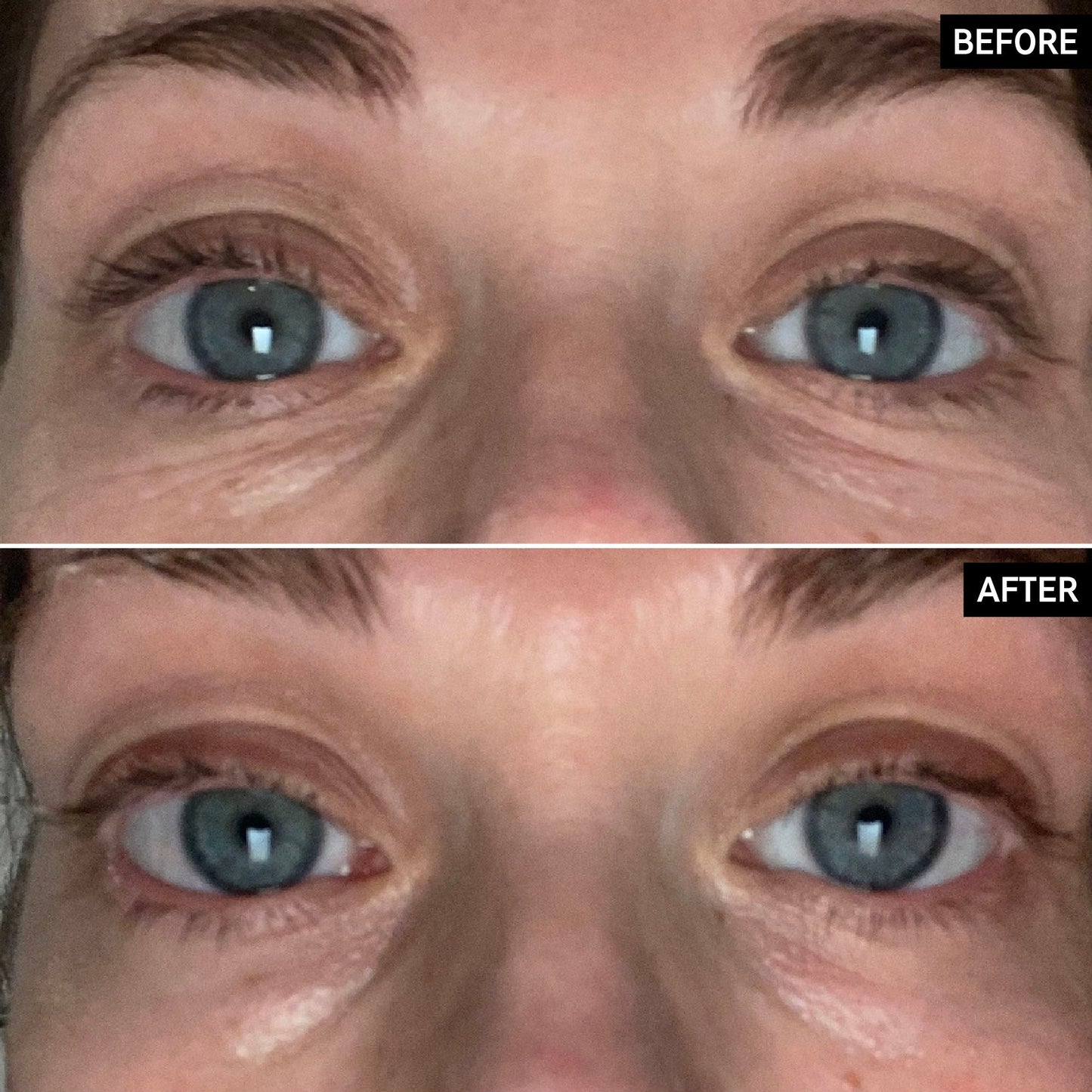 retinol-eye-cream-y6 SITE-UGCBAsApril_Nicole_B_A_PPage_2000x2000_1.jpg