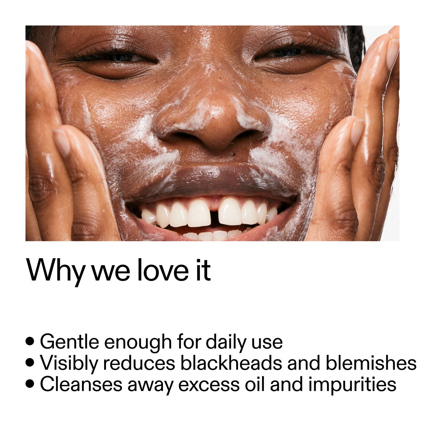 salicylic-acid-cleanser-duo-h5 Salicylic_Acid_Cleanser_-_300mlWhy_we_love_it_2000x2000_87dc92a9-2559-4309-98cd-4e570f1be735.jpg