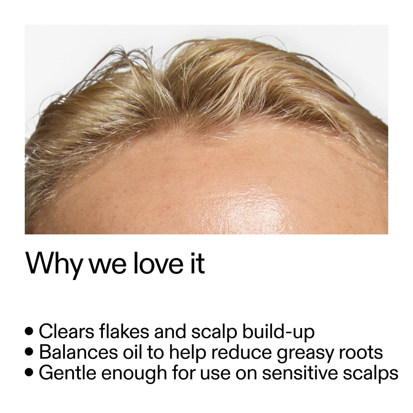 salicylic-acid-exfoliating-scalp-treatment-s9 Salicylic_Acid_Exfoliating_Scalp_Treatment_Why_we_love_it_2000x2000_44b6bd6d-9ec4-4b23-9dc4-bc3fd6f28e14.jpg