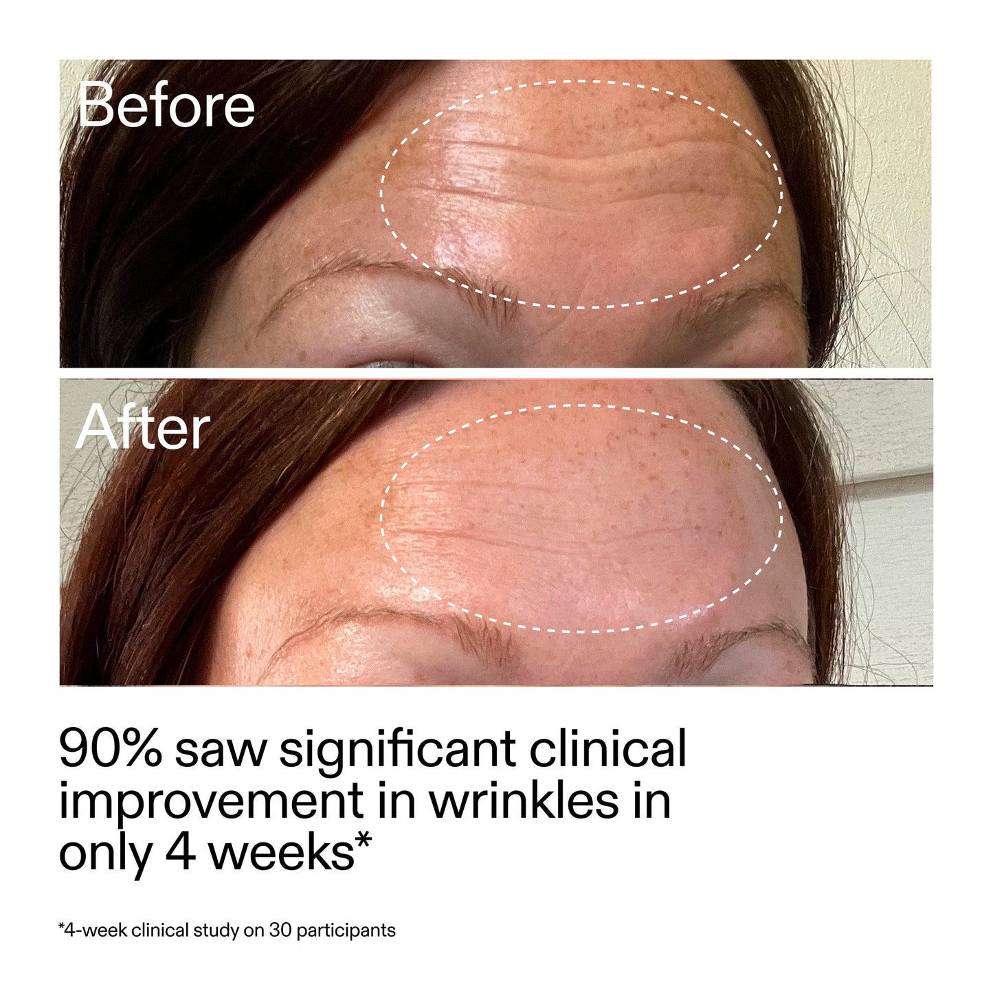 starter-retinol-serum-m4 StarterRetinol_BeforeAfter_Claim1_2000x2000_a09b50b6-4688-4527-abae-21bd142b89b7.jpg
