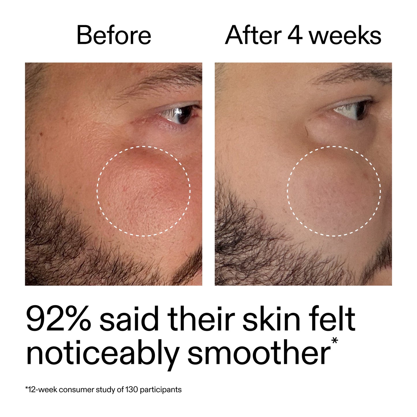 starter-retinol-serum-m4 StarterRetinol_BeforeAfter_Claim3_2000x2000_6ceab106-e0ee-4ed4-ba62-41bc39538038.jpg