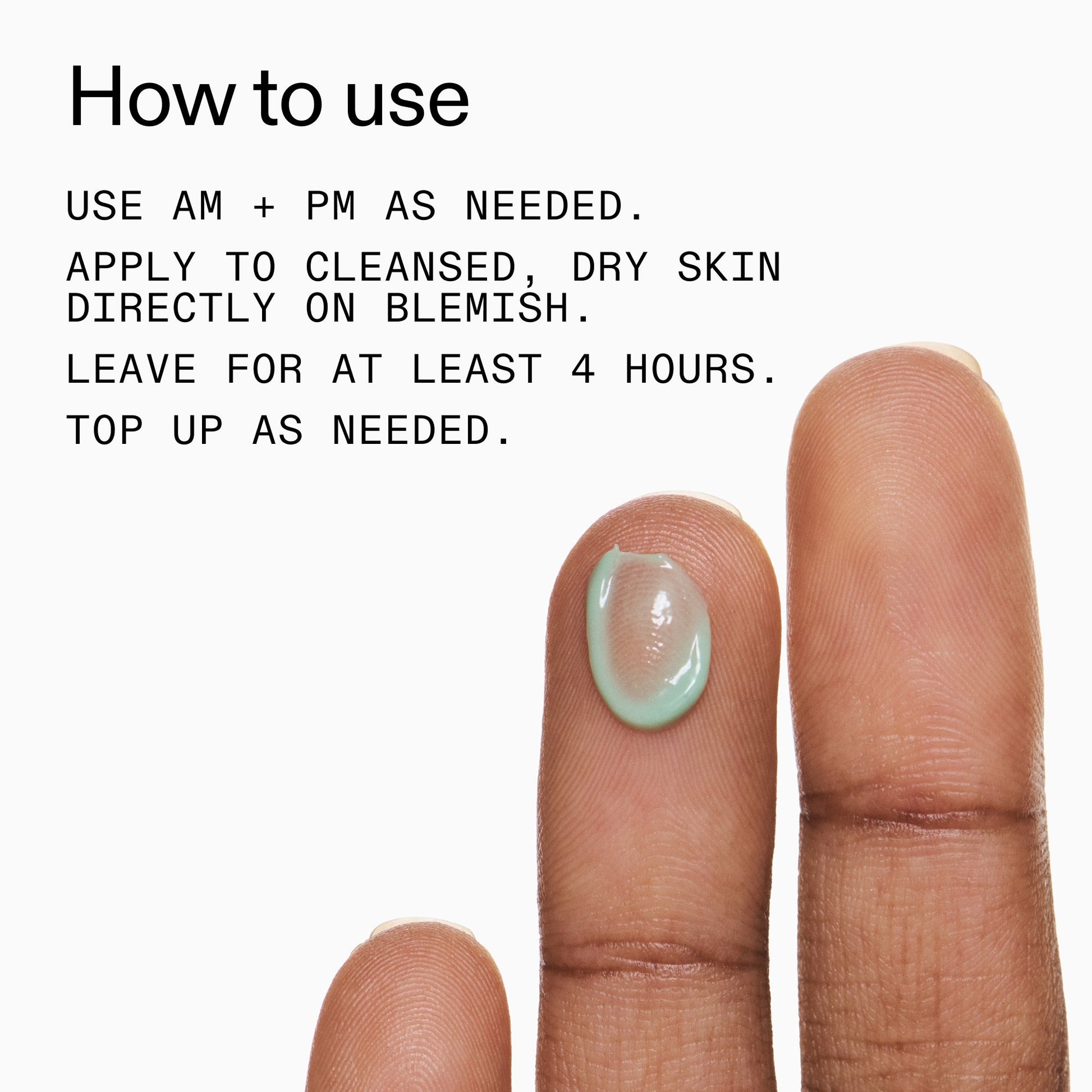 succinic-acid-acne-treatment-a9 Succinic_Acid_Treatment_How_to_Use_2000x2000_d57137d5-d7f1-427c-9a46-5fc00c19c542.jpg