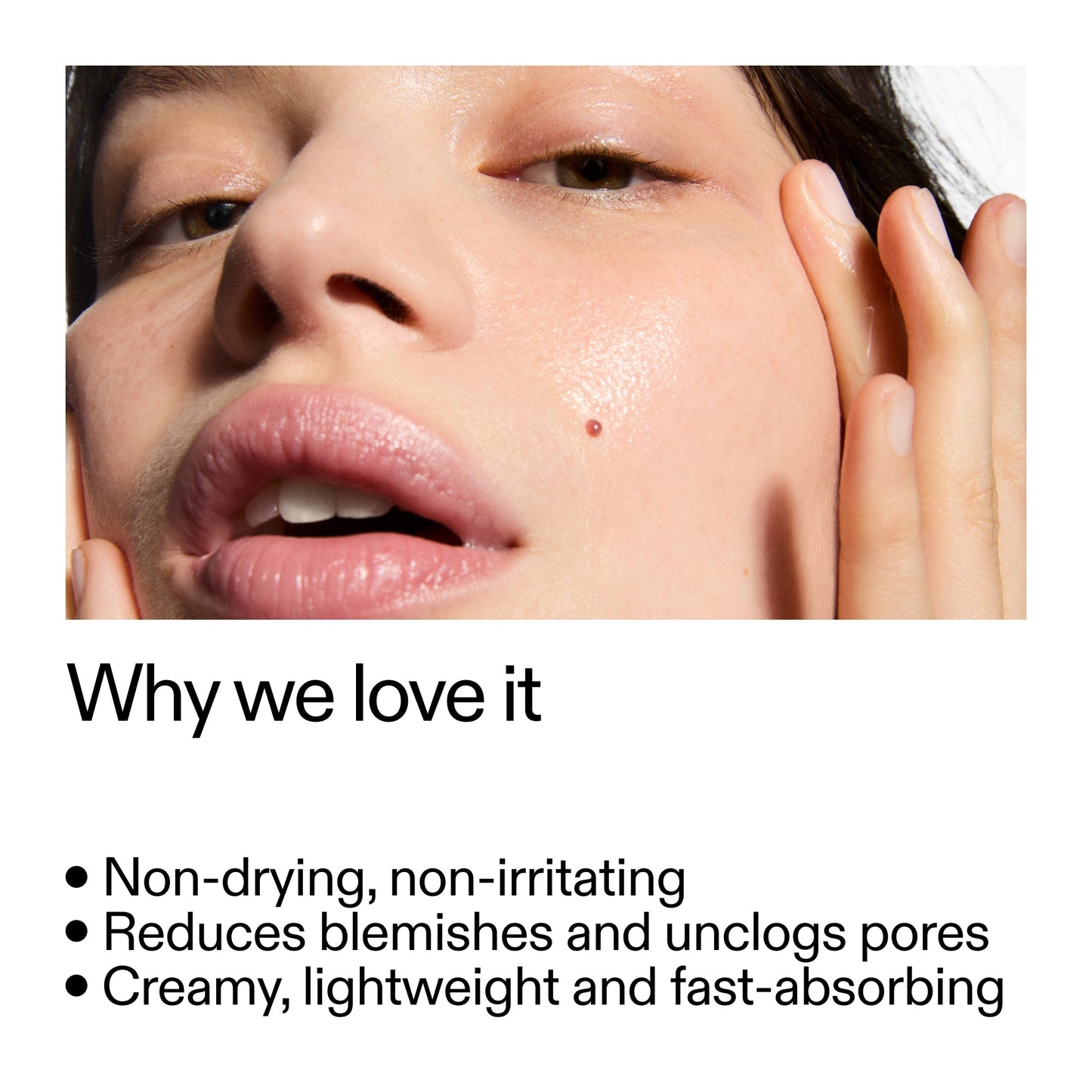 succinic-acid-acne-treatment-a9 Succinic_Acid_Treatment_Why_we_love_it_2000x2000_e90dd42a-cfe9-48b5-a2c7-d5eda787a6a8.jpg
