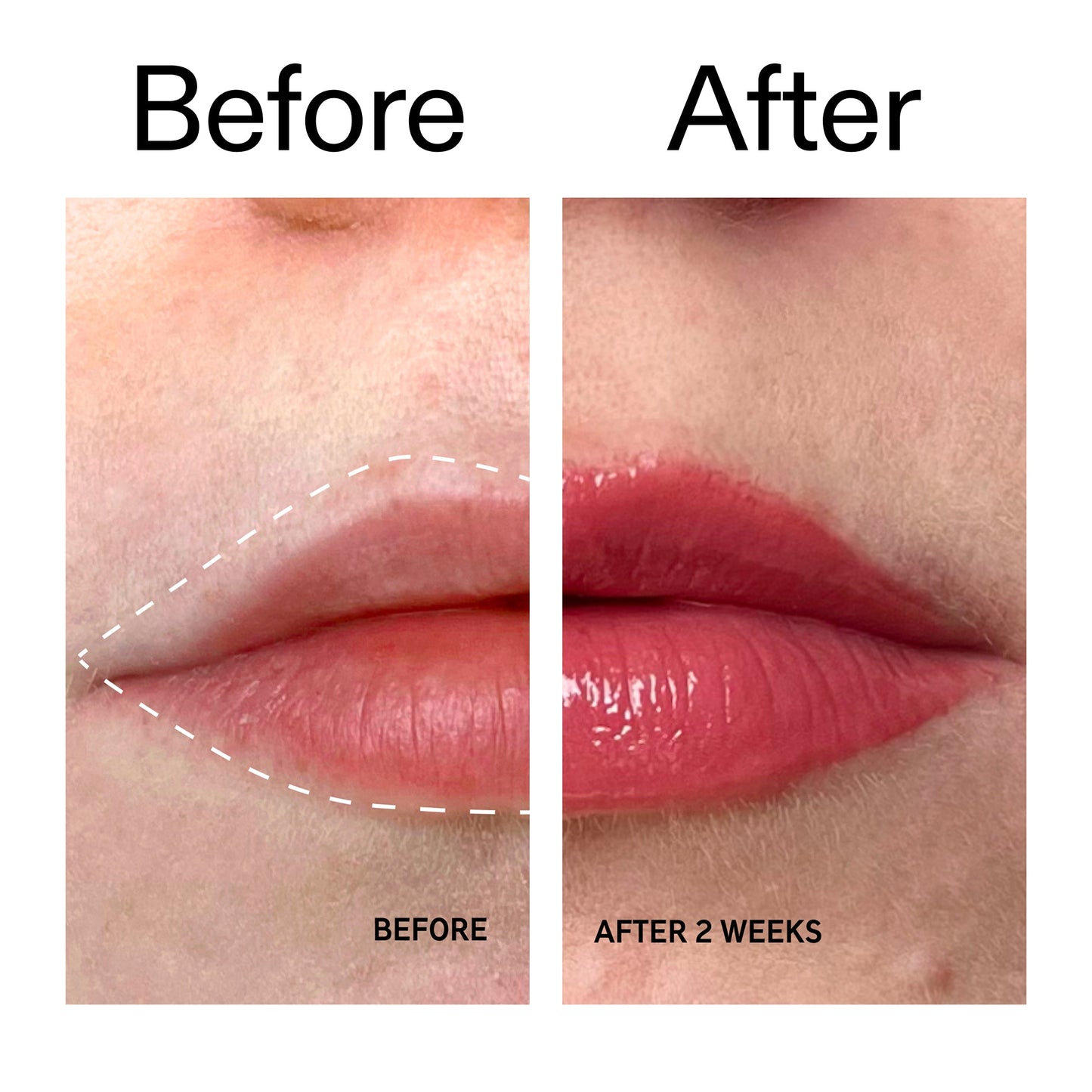 tripeptide-plumping-berry-lip-balm-i8 Tripeptide_Plumping_Lip_Balm_-_Berry_Before_After_2000x2000_9474bbd8-43ca-4b0e-b0e7-dfab70b91927.jpg