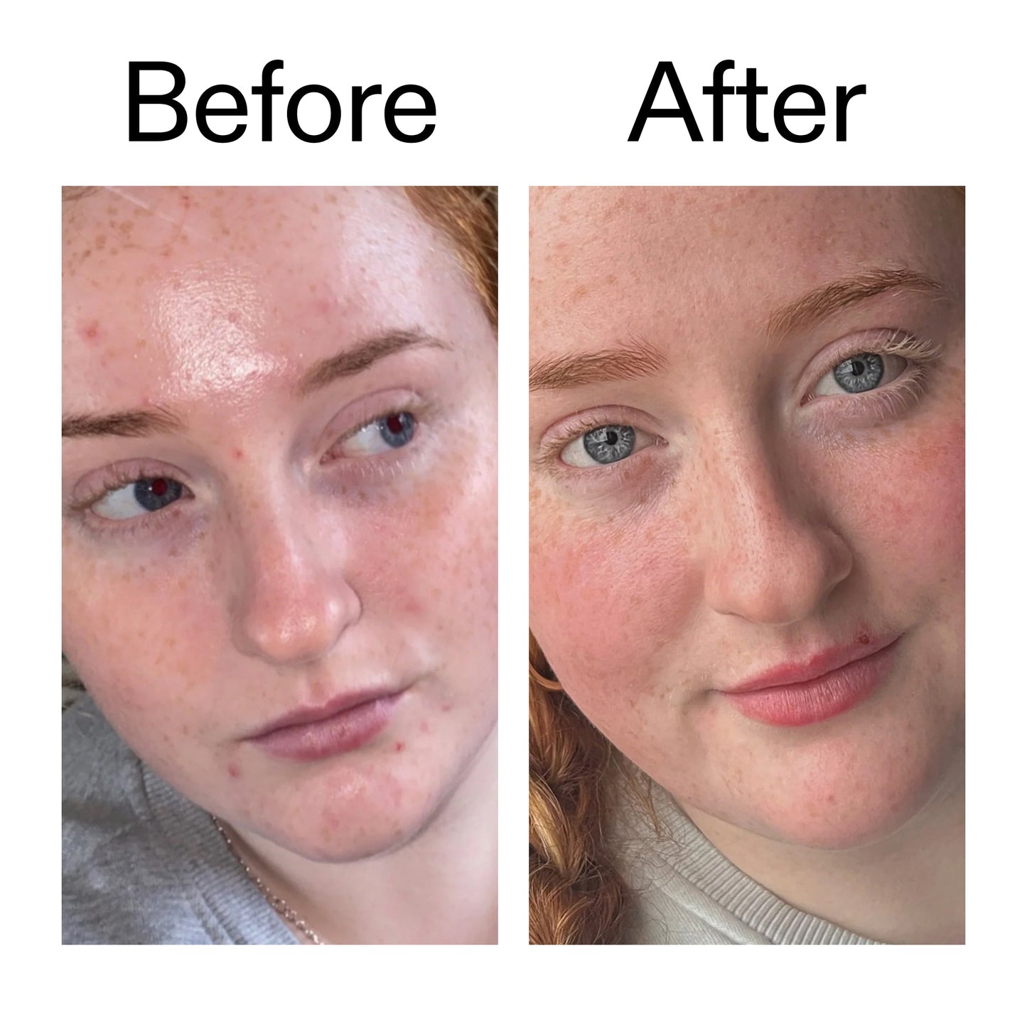 vitamin-b-c-and-e-moisturizer-l1 Vitamin_B_C_and_E_Moisturizer_Before_After_2000x2000_b0781a76-5ad2-4be9-95b8-ef92b356833c.jpg